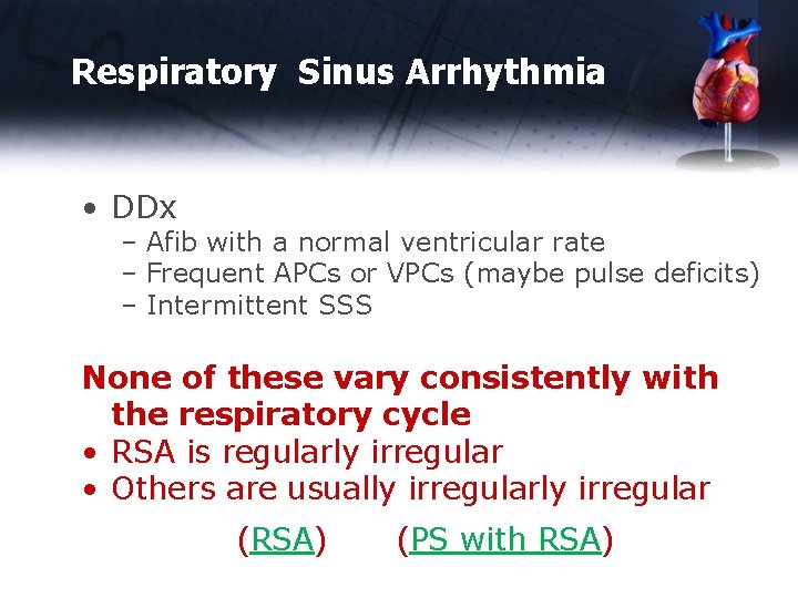 Respiratory Sinus Arrhythmia • DDx – Afib with a normal ventricular rate – Frequent