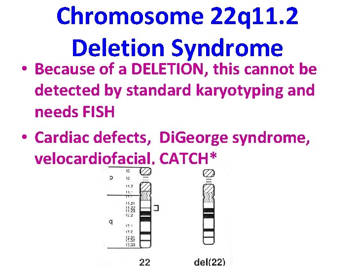 Chromosome 22 q 11. 2 Deletion Syndrome • Because of a DELETION, this cannot