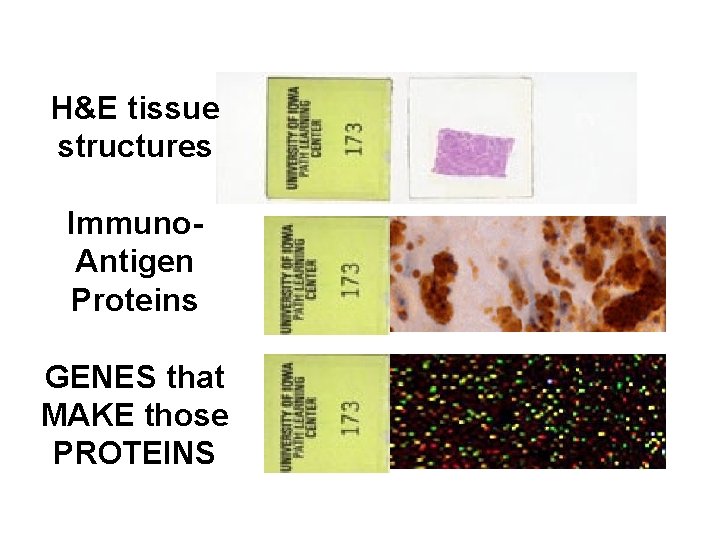 H&E tissue structures Immuno. Antigen Proteins GENES that MAKE those PROTEINS 