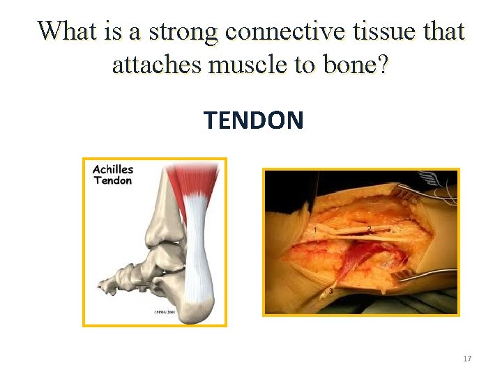What is a strong connective tissue that attaches muscle to bone? TENDON 17 