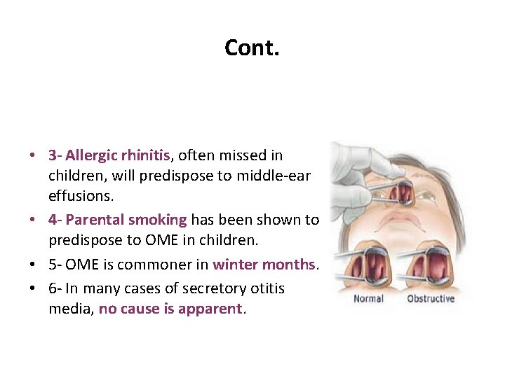 Cont. • 3 - Allergic rhinitis, often missed in children, will predispose to middle-ear