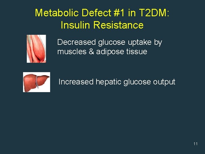 Metabolic Defect #1 in T 2 DM: Insulin Resistance Decreased glucose uptake by muscles