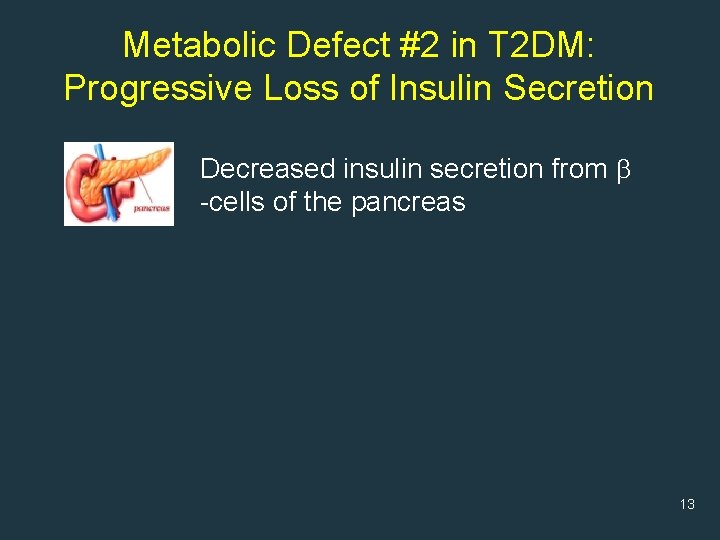 Metabolic Defect #2 in T 2 DM: Progressive Loss of Insulin Secretion Decreased insulin