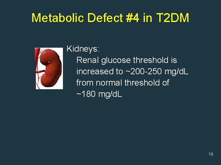 Metabolic Defect #4 in T 2 DM Kidneys: Renal glucose threshold is increased to