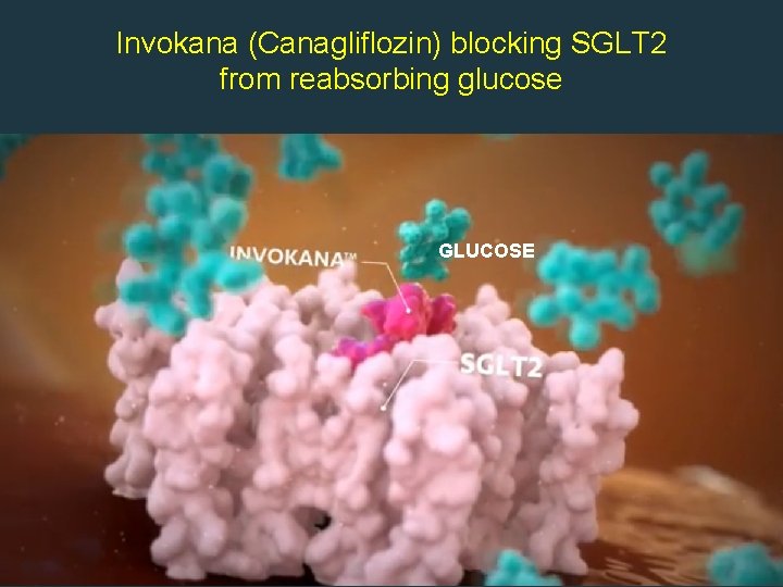 Invokana (Canagliflozin) blocking SGLT 2 from reabsorbing glucose GLUCOSE 