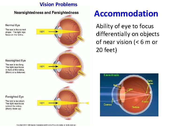 Vision Problems Accommodation Ability of eye to focus differentially on objects of near vision