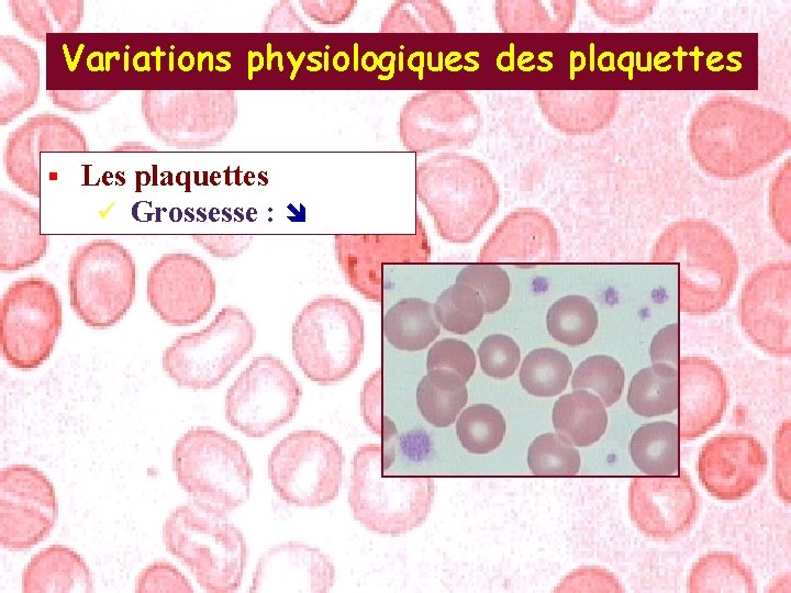 Variations physiologiques des plaquettes § Les plaquettes ü Grossesse : 