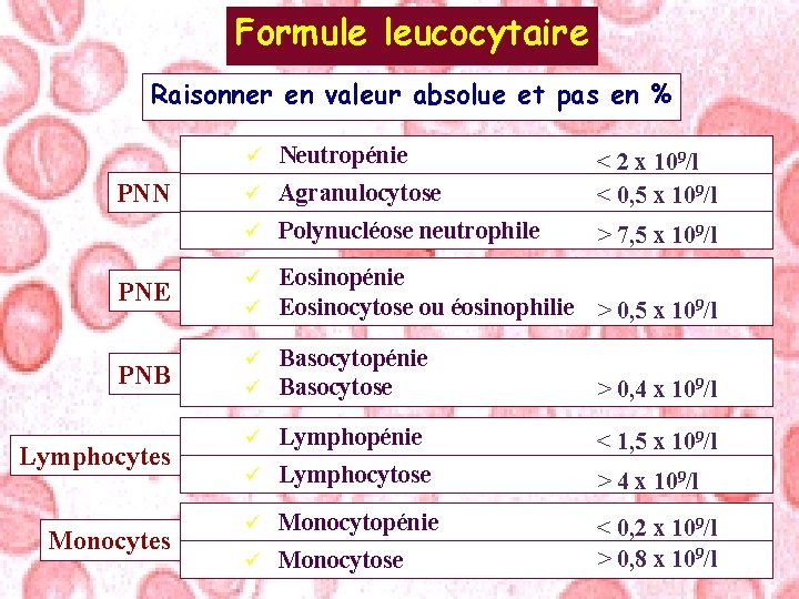 Formule leucocytaire Raisonner en valeur absolue et pas en % ü Neutropénie ü Agranulocytose