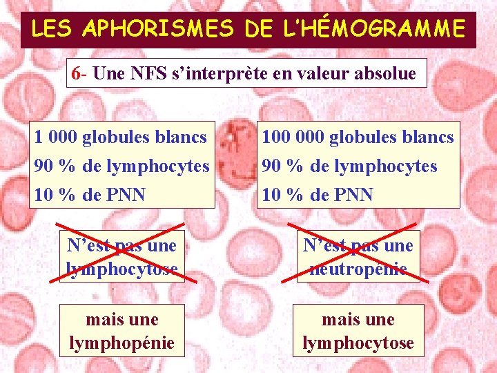 LES APHORISMES DE L’HÉMOGRAMME 6 - Une NFS s’interprète en valeur absolue 1 000