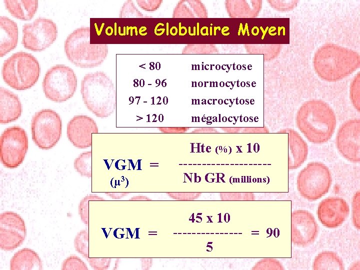 Volume Globulaire Moyen < 80 80 - 96 97 - 120 > 120 VGM