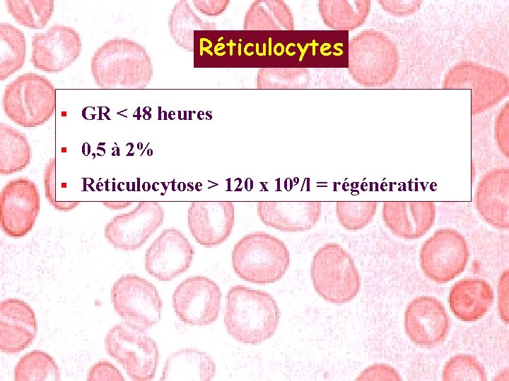 Réticulocytes § GR < 48 heures § 0, 5 à 2% § Réticulocytose >