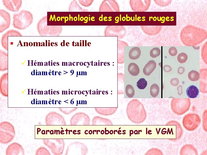 Morphologie des globules rouges § Anomalies de taille ü Hématies macrocytaires : diamètre >