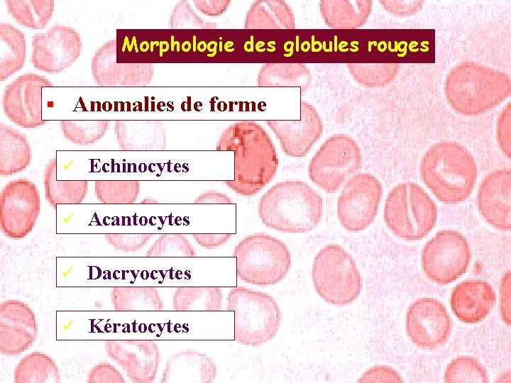 Morphologie des globules rouges § Anomalies de forme ü Echinocytes ü Acantocytes ü Dacryocytes