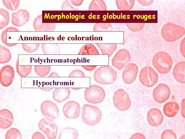 Morphologie des globules rouges § Anomalies de coloration ü ü Polychromatophilie Hypochromie 