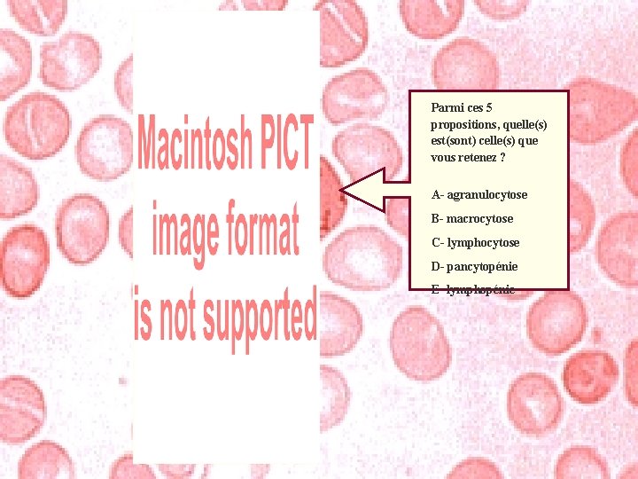 Parmi ces 5 propositions, quelle(s) est(sont) celle(s) que vous retenez ? A- agranulocytose B-