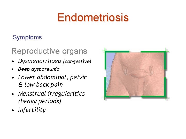 Endometriosis Symptoms Reproductive organs • Dysmenorrhoea (congestive) • Deep dyspareunia • Lower abdominal, pelvic