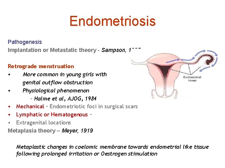 Endometriosis Pathogenesis Implantation or Metastatic theory - Sampson, 1927 Retrograde menstruation • More common