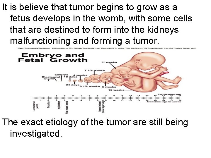 It is believe that tumor begins to grow as a fetus develops in the