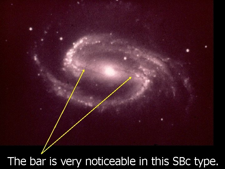The bar is very noticeable in this SBc type. The bar is very noticeable in this SBc type.