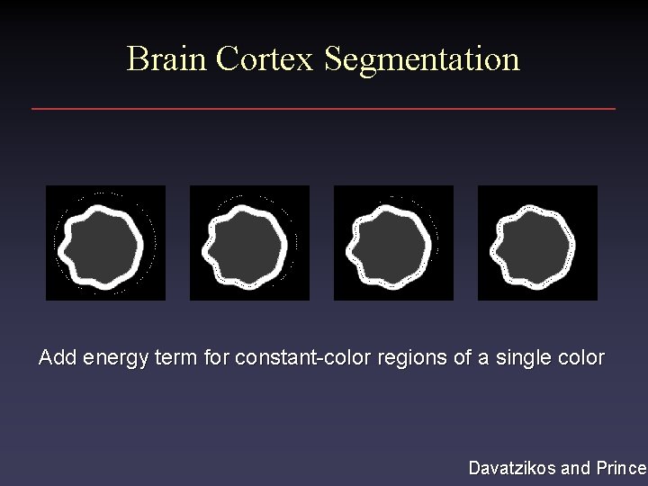 Brain Cortex Segmentation Add energy term for constant-color regions of a single color Davatzikos
