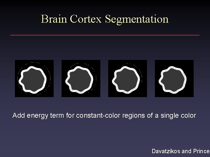 Brain Cortex Segmentation Add energy term for constant-color regions of a single color Davatzikos Brain Cortex Segmentation Add energy term for constant-color regions of a single color Davatzikos