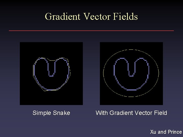 Gradient Vector Fields Simple Snake With Gradient Vector Field Xu and Prince 