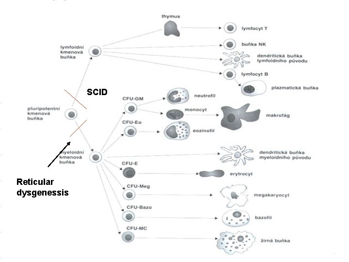 SCID Reticular dysgenessis 