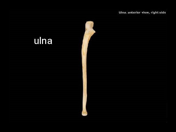 ulna 