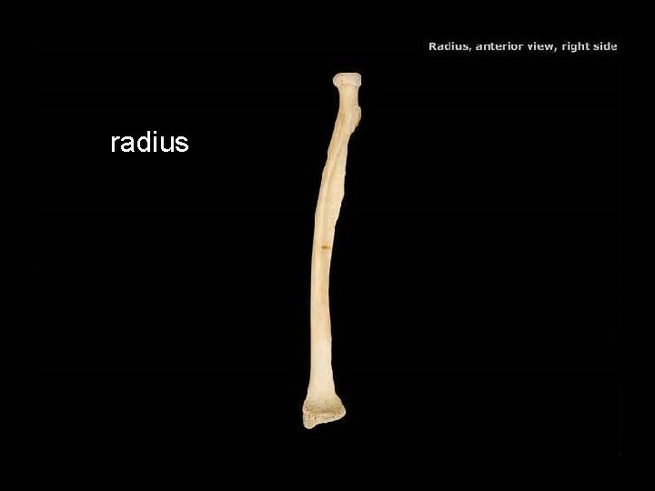 radius 