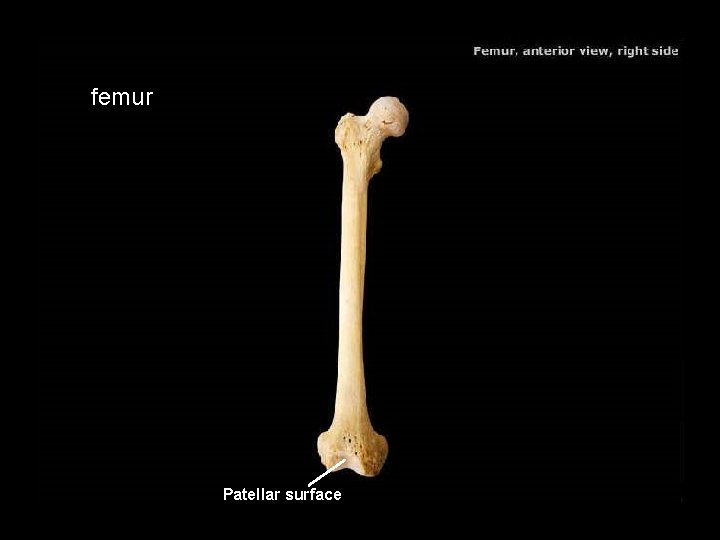 femur Patellar surface 