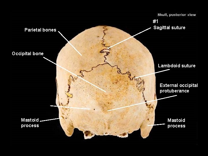 #1 Parietal bones Sagittal suture Occipital bone Lambdoid suture External occipital protuberance Mastoid process
