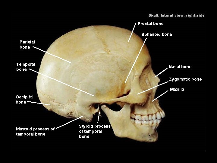 Frontal bone Sphenoid bone Parietal bone Temporal bone Nasal bone Zygomatic bone Maxilla Occipital