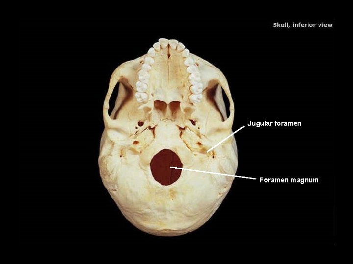 Jugular foramen Foramen magnum 