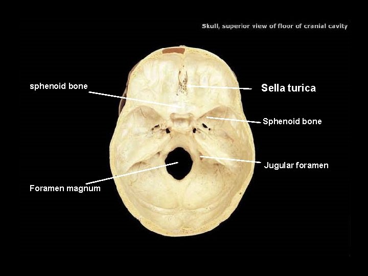 sphenoid bone Sella turica Sphenoid bone Jugular foramen Foramen magnum 