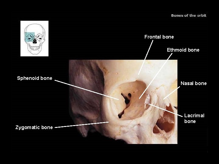 Frontal bone Ethmoid bone Sphenoid bone Nasal bone Lacrimal bone Zygomatic bone 