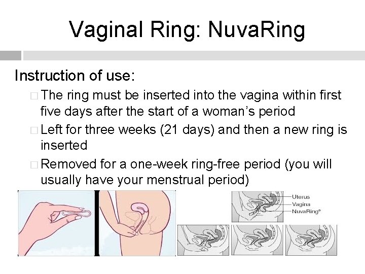 Vaginal Ring: Nuva. Ring Instruction of use: � The ring must be inserted into