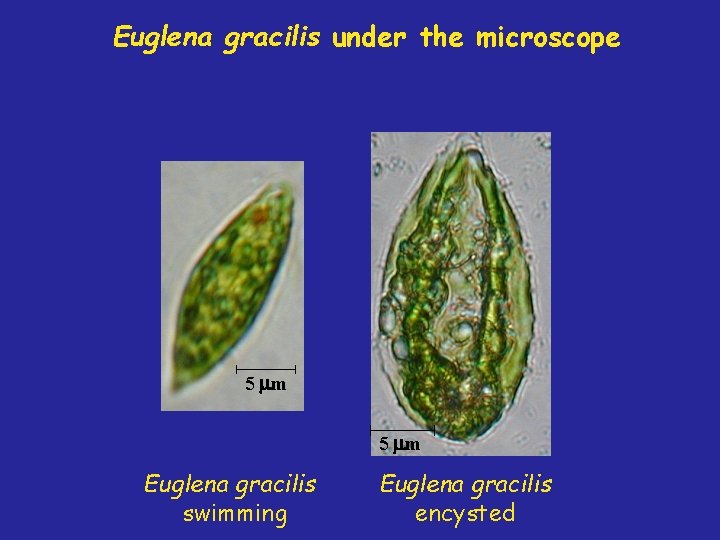 Euglena gracilis under the microscope 5 mm Euglena gracilis swimming Euglena gracilis encysted 