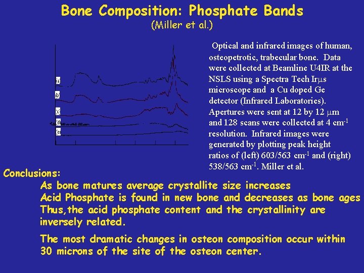 Bone Composition: Phosphate Bands (Miller et al. ) Optical and infrared images of human,