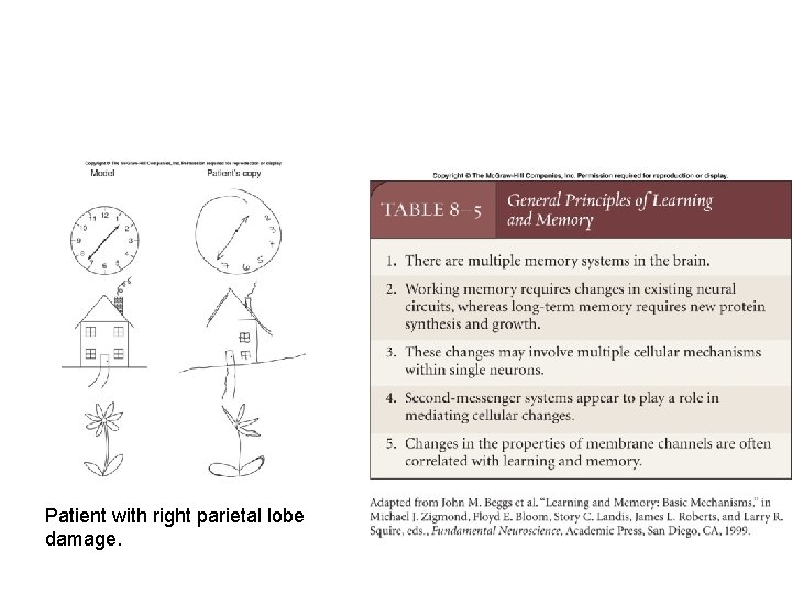 Patient with right parietal lobe damage. 