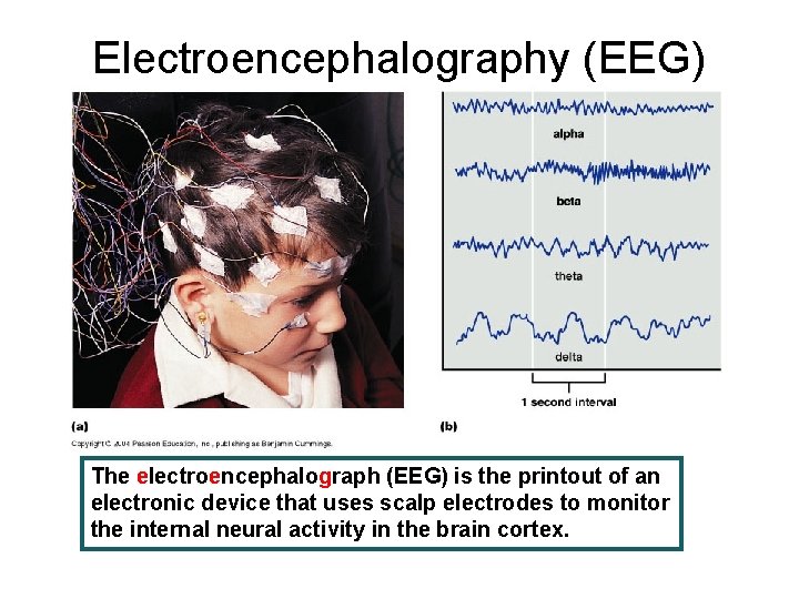 Electroencephalography (EEG) The electroencephalograph (EEG) is the printout of an electronic device that uses