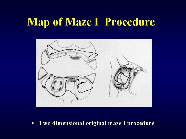 Map of Maze I Procedure • Two dimensional original maze I procedure 