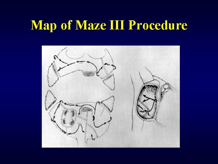 Map of Maze III Procedure 
