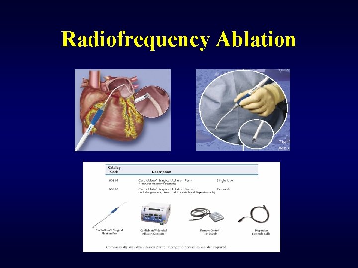 Radiofrequency Ablation 