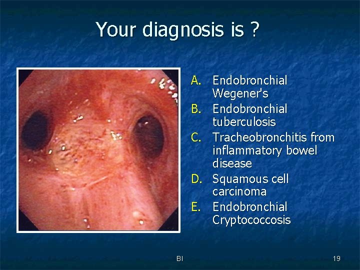 Your diagnosis is ? A. Endobronchial Wegener's B. Endobronchial tuberculosis C. Tracheobronchitis from inflammatory