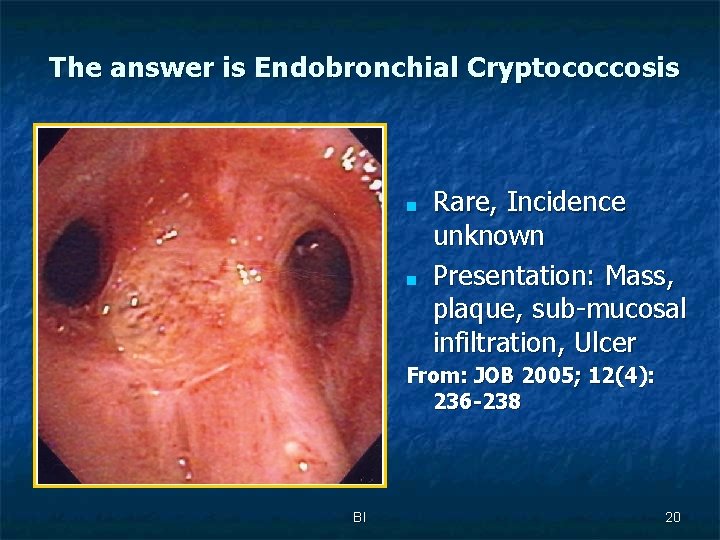 The answer is Endobronchial Cryptococcosis ■ ■ Rare, Incidence unknown Presentation: Mass, plaque, sub-mucosal