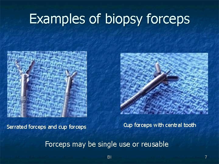 Examples of biopsy forceps Cup forceps with central tooth Serrated forceps and cup forceps