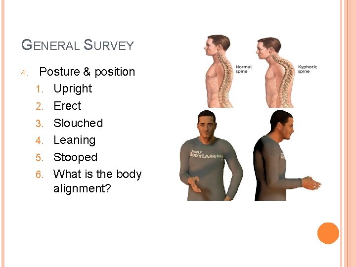 GENERAL SURVEY 4. Posture & position 1. Upright 2. Erect 3. Slouched 4. Leaning
