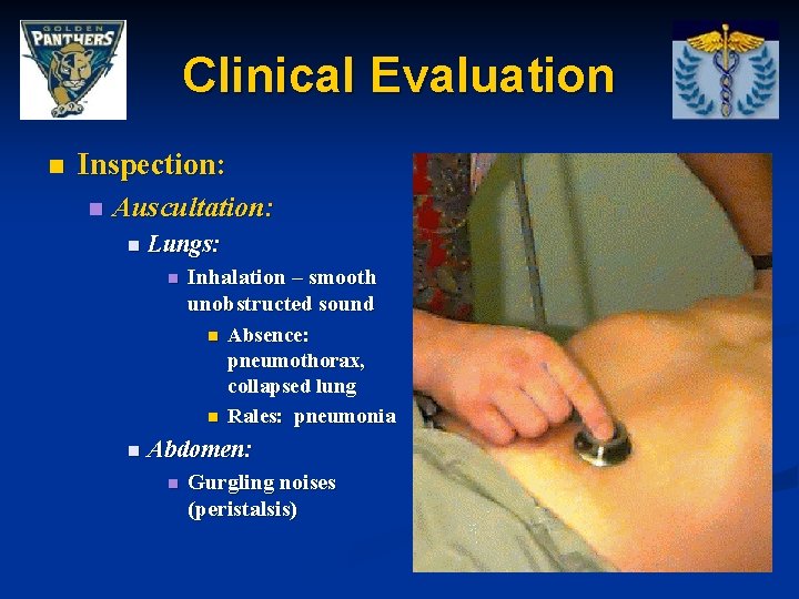 Clinical Evaluation n Inspection: n Auscultation: n Lungs: n Inhalation – smooth unobstructed sound