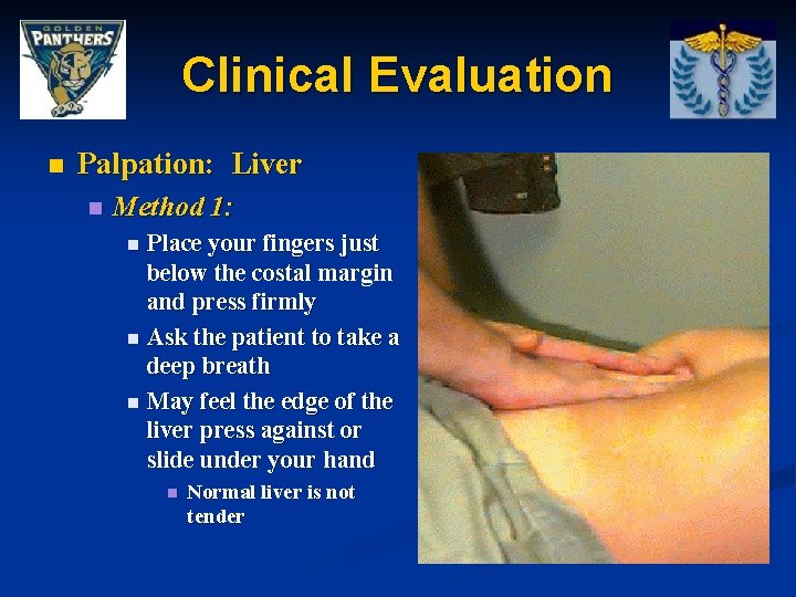 Clinical Evaluation n Palpation: Liver n Method 1: Place your fingers just below the