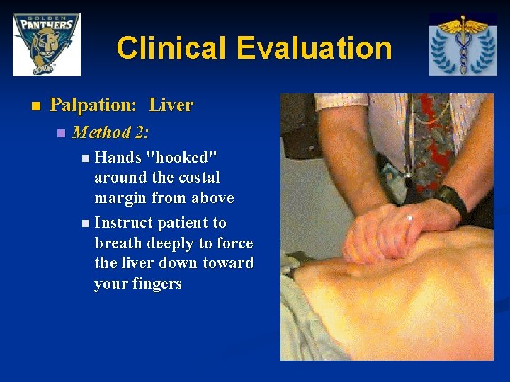 Clinical Evaluation n Palpation: Liver n Method 2: n Hands "hooked" around the costal